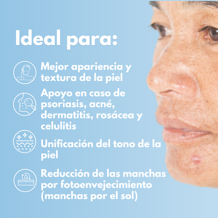 SOD Enzima superóxido dismutasa